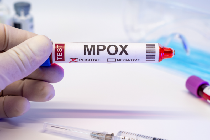 Mpox